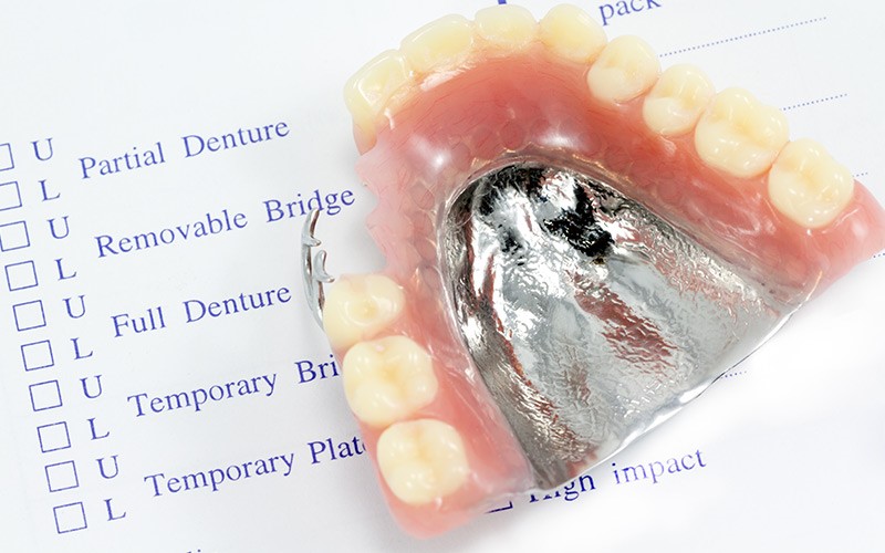 Permanent Dentures Procedure Toledo OH 43655
